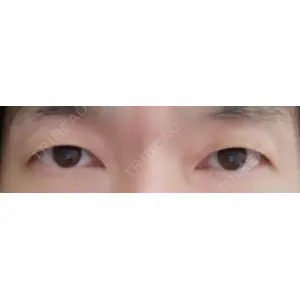 湘南美容クリニック 湘南美容クリニック 宇都宮院口コミ