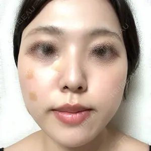東京シンデレラ美容外科 東京シンデレラ美容外科 池袋院口コミ