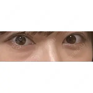 APOLLO BEAUTY CLINIC口コミ