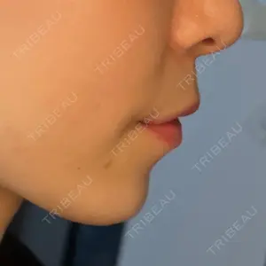 プライベートスキンクリニック 梅田本院口コミ