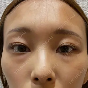 APOLLO BEAUTY CLINIC口コミ