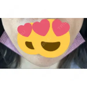 TCB東京中央美容外科 TCB東京中央美容外科 郡山院口コミ