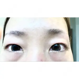 東郷美容形成外科 福岡口コミ
