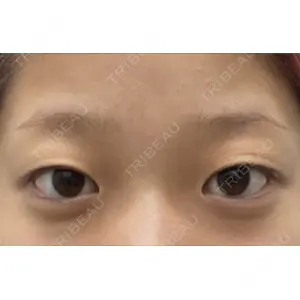 湘南美容クリニック 湘南美容クリニック 池袋東口院口コミ
