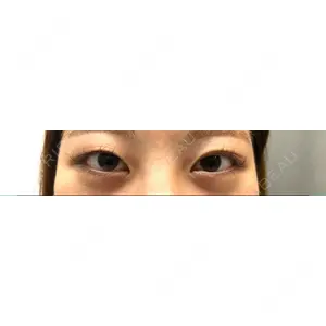 東郷美容形成外科 福岡口コミ