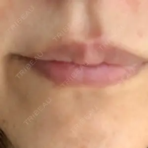 さっぽろ美容クリニックの