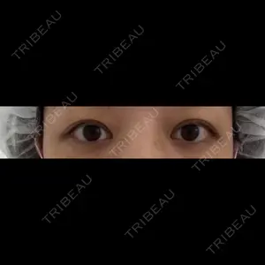 TCB東京中央美容外科 TCB東京中央美容外科 渋谷東口院口コミ
