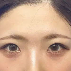 口コミ
