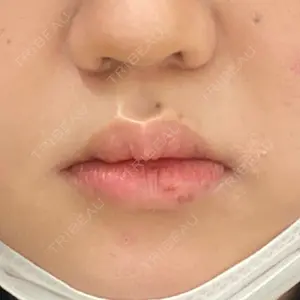 フィラークリニック フィラークリニック 町田院口コミ