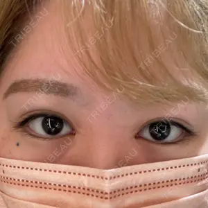 VENUS BEAUTY CLINIC　銀座院口コミ