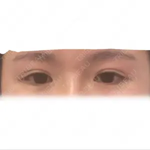 TCB東京中央美容外科 TCB東京中央美容外科 新宿三丁目院口コミ
