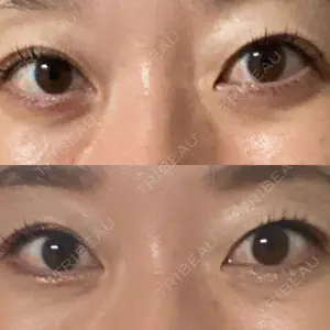 東京シンデレラ美容外科 東京シンデレラ美容外科 池袋院口コミ