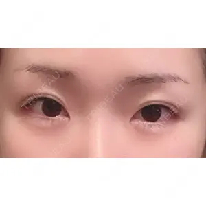 口コミ