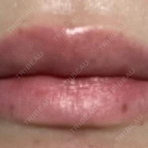 あいちビューティークリニック あいちビューティークリニック栄本院口コミ