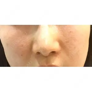 まゆりなclinic 名古屋栄口コミ