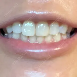 U DENTAL OFFICE 恵比寿口コミ