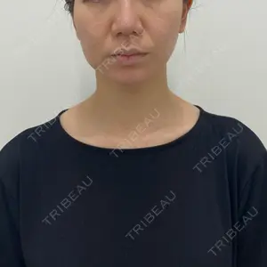 湘南美容クリニック 湘南美容クリニック 秋葉原院口コミ