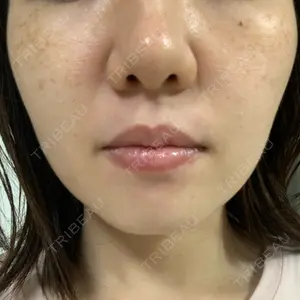まゆりなclinic 名古屋栄口コミ