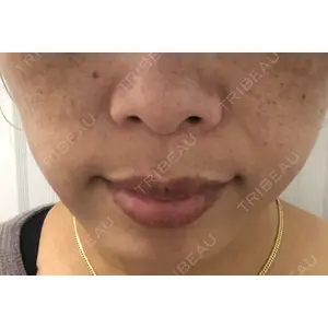 TCB東京中央美容外科 TCB東京中央美容外科 新宿三丁目院口コミ
