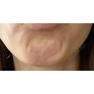 TCB東京中央美容外科 TCB東京中央美容外科 千葉駅前院口コミ