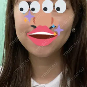口コミ