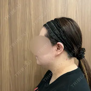 湘南美容クリニック 湘南美容クリニック 秋葉原院口コミ