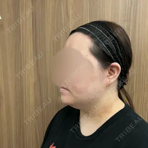 湘南美容クリニック 湘南美容クリニック 秋葉原院口コミ
