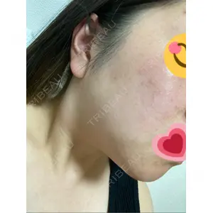 銀座ゼロクリニック口コミ