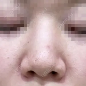 口コミ