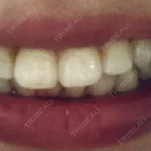 U DENTAL OFFICE 恵比寿口コミ
