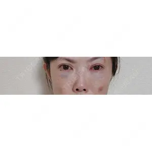 セオリークリニック口コミ