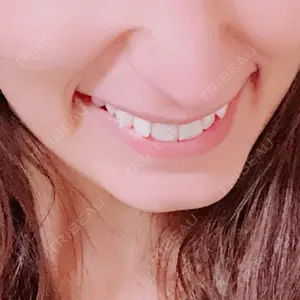 口コミ