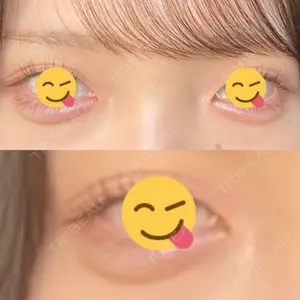 銀座コクリコクリニック口コミ