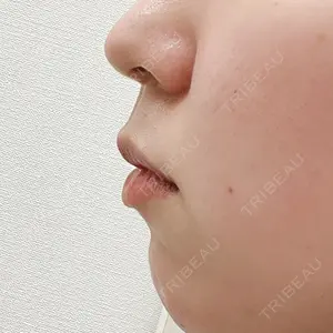 YBC横浜美容外科 YBC横浜美容外科 大宮院口コミ
