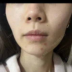 新宿美容外科クリニック 新宿美容外科クリニック 立川院口コミ