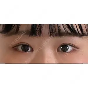 東京イセアクリニック口コミ