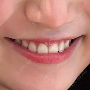 U DENTAL OFFICE 恵比寿口コミ