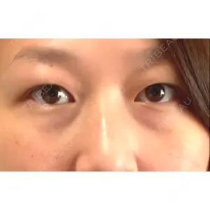 あいちビューティークリニック あいちビューティークリニック口コミ