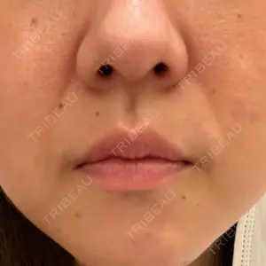 KOBE CLINIC KOBE美容皮膚科 神戸東灘院口コミ