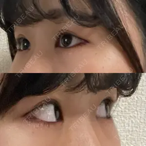東京イセアクリニック口コミ