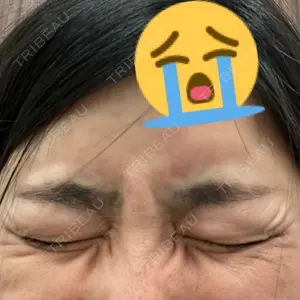 TCB東京中央美容外科 TCB東京中央美容外科 中野院口コミ