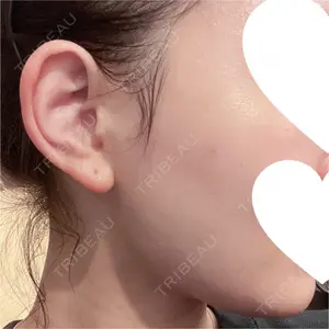銀座ゼロクリニック口コミ