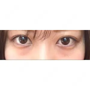 APOLLO BEAUTY CLINIC口コミ