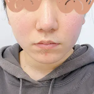 湘南美容クリニック 湘南美容クリニック 銀座院口コミ