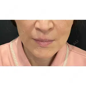 口コミ