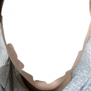 TCB東京中央美容外科 TCB東京中央美容外科 名古屋駅前院口コミ