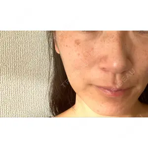 まゆりなclinic 名古屋栄口コミ