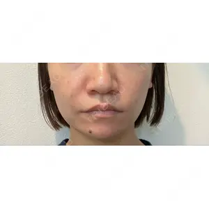 渋谷美容外科クリニック 渋谷美容外科クリニック 渋谷院口コミ