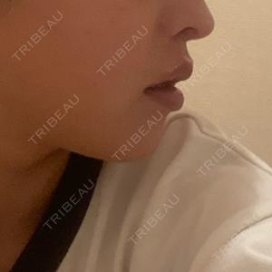 新宿ラクル美容外科クリニック 新宿ラクル美容外科クリニック 新宿院口コミ