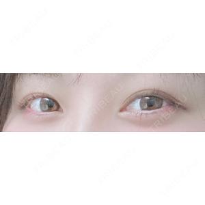 湘南美容クリニック 湘南美容クリニック 仙台院口コミ